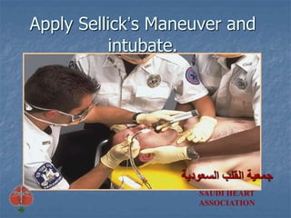 Apply Sellick’s Maneuver and
intubate.
‫السعودية‬ ‫القلب‬ ‫جمعية‬
SAUDI HEART
ASSOCIATION
 