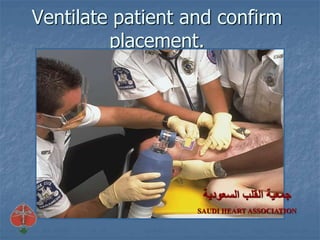 Ventilate patient and confirm
placement.
‫السعودية‬ ‫القلب‬ ‫جمعية‬
SAUDI HEART ASSOCIATION
 