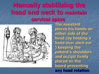 Manually stabilizing the
head and neck to maintain
cervical spine
 The assistant
places his hands on
either side of the
head (by holding a
hand over each ear
) keeping the
patient's shoulders
and occipit firmly
placed on the
board preventing
any head rotation
 