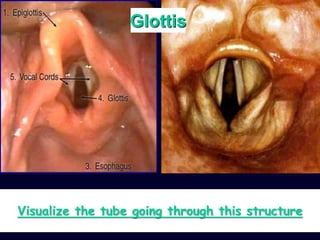 Visualize the tube going through this structure
Glottis
 