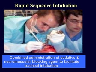 Rapid Sequence Intubation
Combined administration of sedative &
neuromuscular blocking agent to facilitate
tracheal intubation.
 