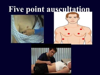 Five point auscultation
 