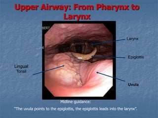Upper Airway: From Pharynx to
Larynx
Uvula
Epiglottis
Larynx
Midline guidance:
“The uvula points to the epiglottis, the epiglottis leads into the larynx”.
Lingual
Tonsil
 