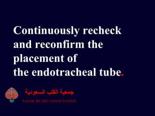 Continuously recheck
and reconfirm the
placement of
the endotracheal tube.
‫السعودية‬ ‫القلب‬ ‫جمعية‬
SAUDI HEART ASSOCIATION
 
