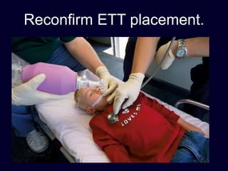 Reconfirm ETT placement.
 