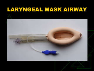 LARYNGEAL MASK AIRWAY
 