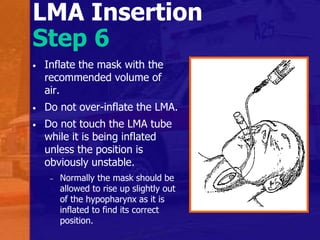 LMA Insertion
Step 6
• Inflate the mask with the
recommended volume of
air.
• Do not over-inflate the LMA.
• Do not touch the LMA tube
while it is being inflated
unless the position is
obviously unstable.
– Normally the mask should be
allowed to rise up slightly out
of the hypopharynx as it is
inflated to find its correct
position.
 