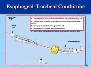 291
Esophageal-Tracheal Combitube
A = esophageal obturator; ventilation into trachea through side openings = B
C = tracheal tube; ventilation through open end if proximal end inserted in
trachea
D = pharyngeal cuff; inflated through catheter = E
F = esophageal cuff; inflated through catheter = G
H = teeth marker; blindly insert Combitube until marker is at level of teeth
Distal
End
Proximal End
B
C
D
E
F
G
H
A
 