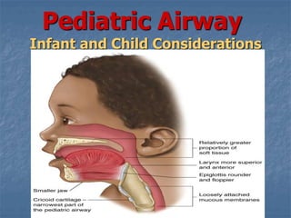 Pediatric Airway
Infant and Child Considerations
 
