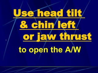 [
to open the A/W
Use head tilt
& chin left
or jaw thrust
 