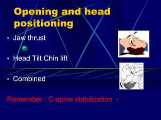 Opening and head
positioning
• Jaw thrust
• Head Tilt Chin lift
• Combined
•Remember : C-spine stabilization
 