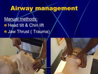 Airway management
Manual methods:
Head tilt & Chin lift
Jaw Thrust ( Trauma)
 