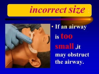 incorrect size :
• If an airway
is too
small ,it
may obstruct
the airway.
 