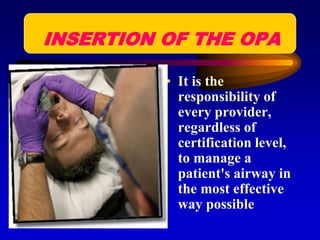 INSERTION OF THE OPA :
• It is the
responsibility of
every provider,
regardless of
certification level,
to manage a
patient's airway in
the most effective
way possible
 