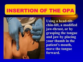 INSERTION OF THE OPA
• Using a head-tilt-
chin-lift, a modified
jaw-thrust, or by
grasping the tongue
and jaw by placing
your thumb in the
patient's mouth,
move the tongue
forward.
 