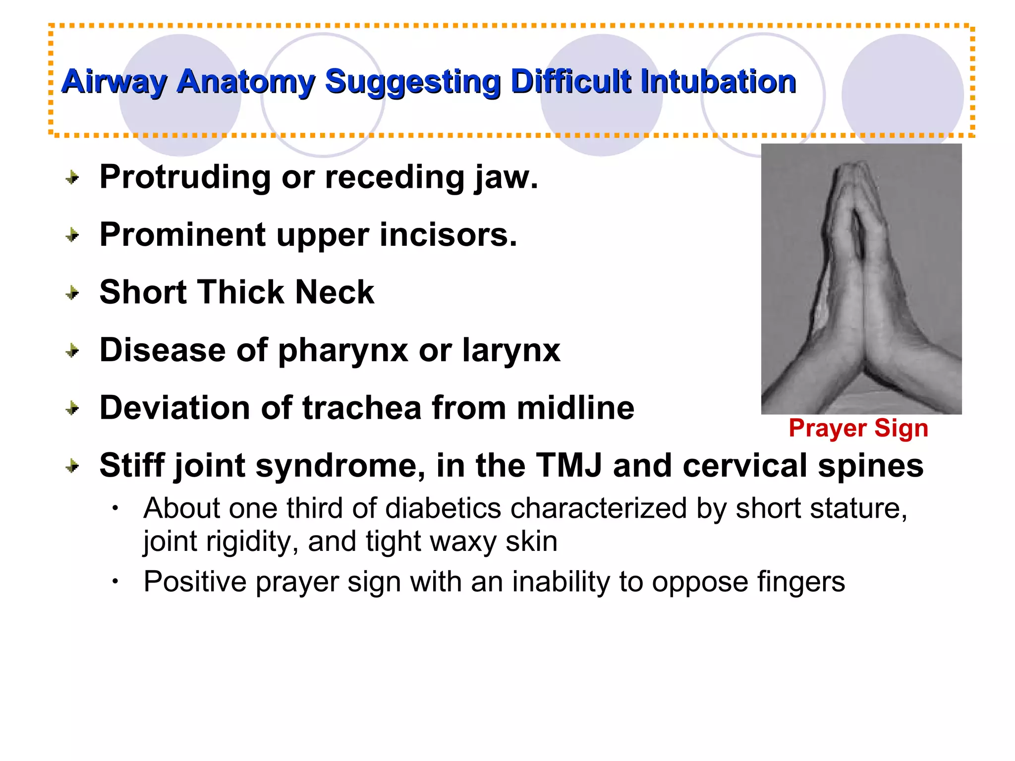 Airway Anatomy Suggesting Difficult Intubation Protruding or receding jaw. Prominent upper incisors.  Short Thick Neck Disease of pharynx or larynx Deviation of trachea from midline Stiff joint syndrome, in the TMJ and cervical spines About one third of diabetics characterized by short stature, joint rigidity, and tight waxy skin Positive prayer sign with an inability to oppose fingers Prayer Sign 