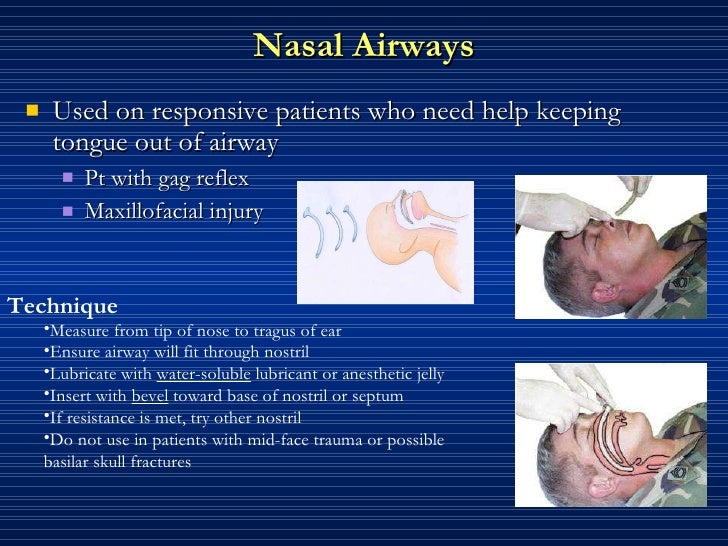Airway management
