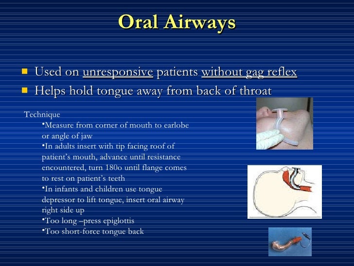 Airway management