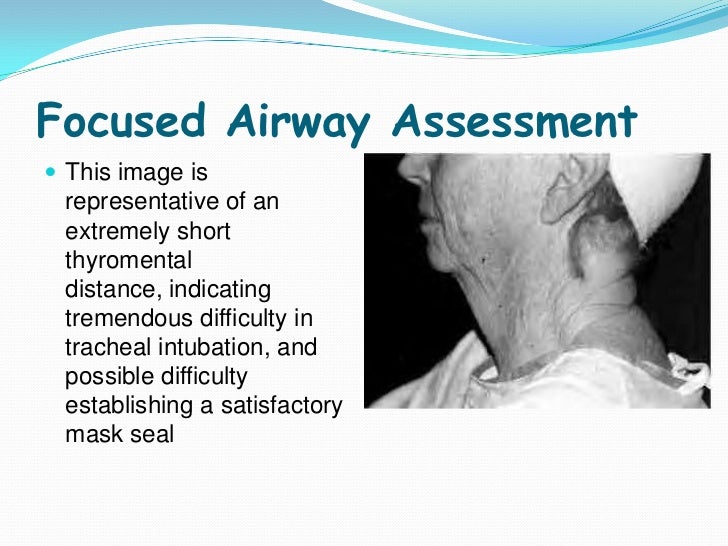 Airway management in for seadtion