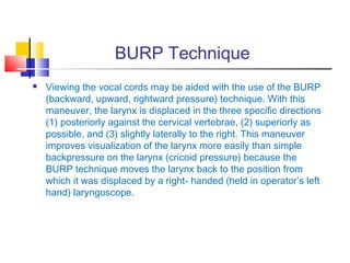 Airway management | PPT
