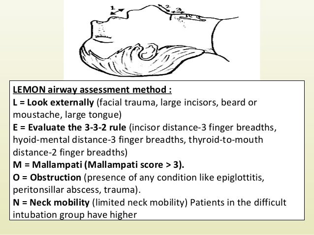 Airway Management