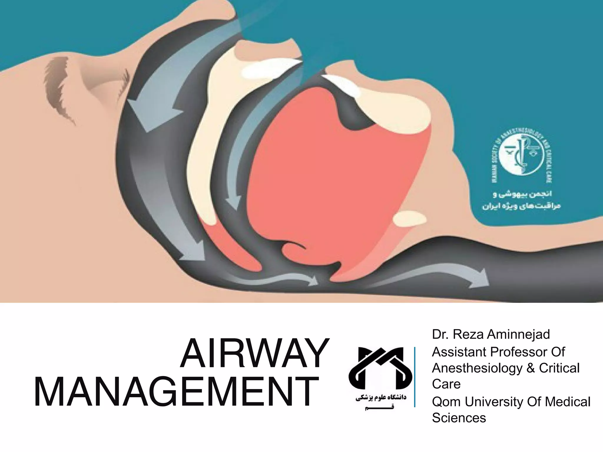 Down Syndrome & Airway Management: The Unexpected Challenges - xzccv8f