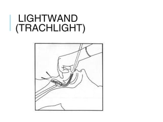 LIGHTWAND
(TRACHLIGHT)
 