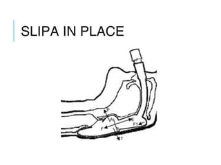 SLIPA IN PLACE
 
