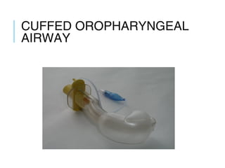 CUFFED
OROPHARYNGEAL
AIRWAY
 