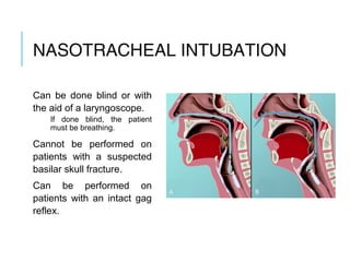 NASOTRACH
EAL
INTUBATION
Can be done blind or with
the aid of a laryngoscope.
If done blind, the patient
must be breathing.
Cannot be performed on
patients with a suspected
basilar skull fracture.
Can be performed on
patients with an intact gag
reflex.
 
