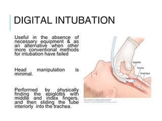 DIGITAL INTUBATION
Useful in the absence of
necessary equipment & as
an alternative when other
more conventional methods
for intubation have failed
Head manipulation is
minimal.
Performed by physically
finding the epiglottis with
middle and index fingers,
and then sliding the tube
interiorly into the trachea.
 