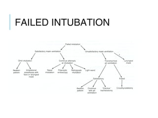 FAILED INTUBATION
 
