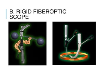 B. RIGID FIBEROPTIC
SCOPE
 