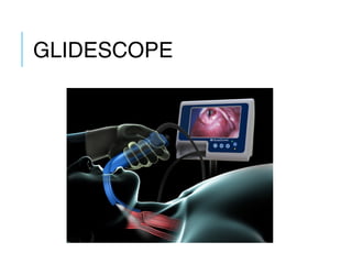 GLIDESCOPE
 