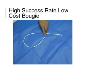 High Success Rate Low
Cost Bougie
 
