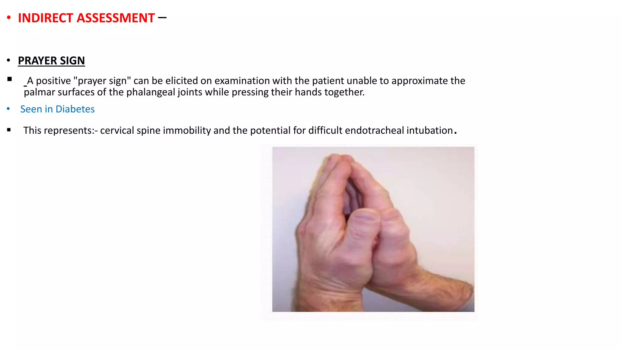 Airway management.pptx