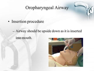 AIRWAY Management ppt
