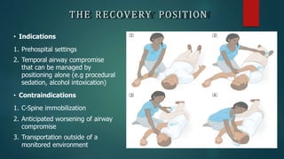 THE RECOVERY POSITION
• Indications
1. Prehospital settings
2. Temporal airway compromise
that can be managed by
positioning alone (e.g procedural
sedation, alcohol intoxication)
• Contraindications
1. C-Spine immobilization
2. Anticipated worsening of airway
compromise
3. Transportation outside of a
monitored environment
 