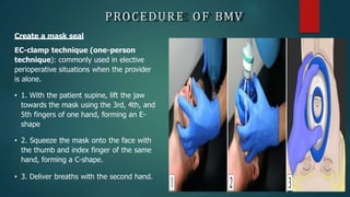 PROCEDURE OF BMV
Create a mask seal
EC-clamp technique (one-person
technique): commonly used in elective
perioperative situations when the provider
is alone.
• 1. With the patient supine, lift the jaw
towards the mask using the 3rd, 4th, and
5th fingers of one hand, forming an E-
shape
• 2. Squeeze the mask onto the face with
the thumb and index finger of the same
hand, forming a C-shape.
• 3. Deliver breaths with the second hand.
 