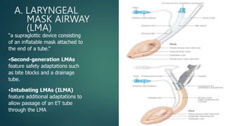 A. LARYNGEAL
MASK AIRWAY
(LMA)
“a supraglottic device consisting
of an inflatable mask attached to
the end of a tube.”
•Second-generation LMAs
feature safety adaptations such
as bite blocks and a drainage
tube.
•Intubating LMAs (ILMA)
feature additional adaptations to
allow passage of an ET tube
through the LMA.
 