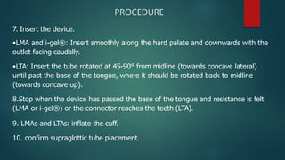 PROCEDURE
7. Insert the device.
•LMA and i-gel®: Insert smoothly along the hard palate and downwards with the
outlet facing caudally.
•LTA: Insert the tube rotated at 45-90° from midline (towards concave lateral)
until past the base of the tongue, where it should be rotated back to midline
(towards concave up).
8.Stop when the device has passed the base of the tongue and resistance is felt
(LMA or i-gel®) or the connector reaches the teeth (LTA).
9. LMAs and LTAs: inflate the cuff.
10. confirm supraglottic tube placement.
 