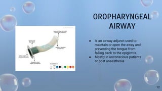 OROPHARYNGEAL
AIRWAY
● Is an airway adjunct used to
maintain or open the away and
preventing the tongue from
falling back to the epiglottis.
● Mostly in unconscious patients
or post anaesthesia
12
 