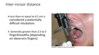 AIRWAY MANAGEMENT in the medical field.pptx