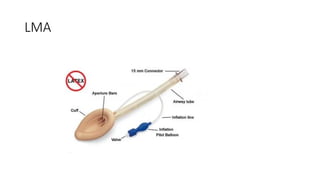 AIRWAY MANAGEMENT in the management of patients | PPTX