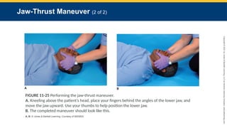 Emergency transport and care of the sick 12th editionAirway Management.pptx