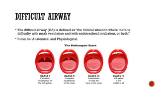 Mask Difficulty Airway management, respiratory management.pptx