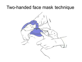 Airway management- INTUBATION.pptx