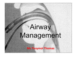 Airway
Management
Ms Tissymol Thomas
 