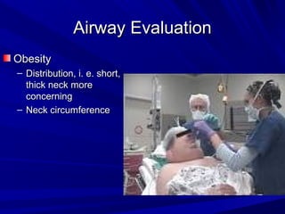Airway EvaluationAirway Evaluation
ObesityObesity
– Distribution, i. e. short,Distribution, i. e. short,
thick neck morethick neck more
concerningconcerning
– Neck circumferenceNeck circumference
 
