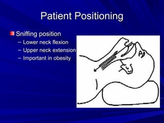 Patient PositioningPatient Positioning
Sniffing positionSniffing position
– Lower neck flexionLower neck flexion
– Upper neck extensionUpper neck extension
– Important in obesityImportant in obesity
 